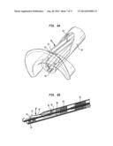 APPARATUS AND METHOD FOR HEART VALVE REPAIR diagram and image