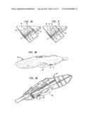 APPARATUS AND METHOD FOR HEART VALVE REPAIR diagram and image