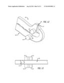 LIGATION CLIP diagram and image