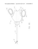 ACTUATION MECHANISM FOR USE WITH AN ULTRASONIC SURGICAL INSTRUMENT diagram and image