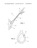 TISSUE PROTECTOR SUTURE CONSTRUCTS diagram and image