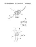 TISSUE PROTECTOR SUTURE CONSTRUCTS diagram and image