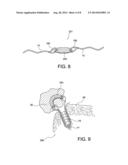 TISSUE PROTECTOR SUTURE CONSTRUCTS diagram and image