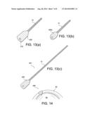 TISSUE PROTECTOR SUTURE CONSTRUCTS diagram and image