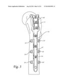 Dynamic Compression Plate diagram and image