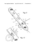 Dynamic Compression Plate diagram and image