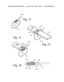 Dynamic Compression Plate diagram and image