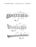 Dynamic Compression Plate diagram and image