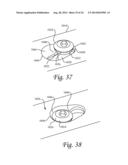 Dynamic Compression Plate diagram and image