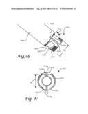 Dynamic Compression Plate diagram and image