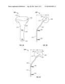 IMPLANT FOR PROMOTING STABILITY OF THE CANINE STIFLE JOINT diagram and image