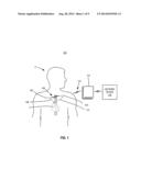 NEUROSTIMULATION CONTROLLED BY ASSESSMENT OF CARDIOVASCULAR RISK diagram and image