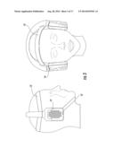 Systems, Methods and apparatus for Bilateral Caloric Vestibular     Stimulation diagram and image