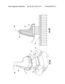 Systems, Methods and apparatus for Bilateral Caloric Vestibular     Stimulation diagram and image