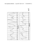 Systems, Methods and apparatus for Bilateral Caloric Vestibular     Stimulation diagram and image