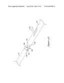 DELIVERY SYSTEM HAVING STENT LOCKING STRUCTURE diagram and image