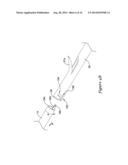 DELIVERY SYSTEM HAVING STENT LOCKING STRUCTURE diagram and image