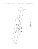 DELIVERY SYSTEM HAVING STENT LOCKING STRUCTURE diagram and image