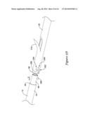 DELIVERY SYSTEM HAVING STENT LOCKING STRUCTURE diagram and image