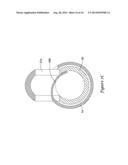 DELIVERY SYSTEM HAVING STENT LOCKING STRUCTURE diagram and image