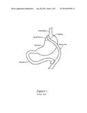 STENT WITH BALLOON FOR REPAIR OF ANASTOMOSIS SURGERY LEAKS diagram and image