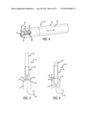 Inversion Delivery Device and Method For A Prosthesis diagram and image