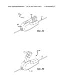 Inversion Delivery Device and Method For A Prosthesis diagram and image