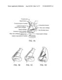 NASAL IMPLANTS AND SYSTEMS AND METHODS OF USE diagram and image