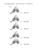 NASAL IMPLANTS AND SYSTEMS AND METHODS OF USE diagram and image