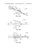 NASAL IMPLANTS AND SYSTEMS AND METHODS OF USE diagram and image