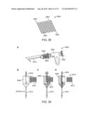 NASAL IMPLANTS AND SYSTEMS AND METHODS OF USE diagram and image