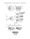 NASAL IMPLANTS AND SYSTEMS AND METHODS OF USE diagram and image