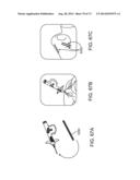 NASAL IMPLANTS AND SYSTEMS AND METHODS OF USE diagram and image