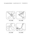 NASAL IMPLANTS AND SYSTEMS AND METHODS OF USE diagram and image