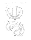 BICRUCIATE RETAINING TIBIAL IMPLANT SYSTEM diagram and image