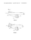 BICRUCIATE RETAINING TIBIAL IMPLANT SYSTEM diagram and image