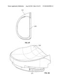 BICRUCIATE RETAINING TIBIAL IMPLANT SYSTEM diagram and image