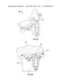 BICRUCIATE RETAINING TIBIAL IMPLANT SYSTEM diagram and image