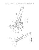 BICRUCIATE RETAINING TIBIAL IMPLANT SYSTEM diagram and image