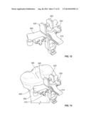 BICRUCIATE RETAINING TIBIAL IMPLANT SYSTEM diagram and image