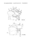 BICRUCIATE RETAINING TIBIAL IMPLANT SYSTEM diagram and image