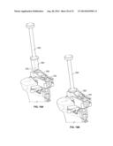 BICRUCIATE RETAINING TIBIAL IMPLANT SYSTEM diagram and image