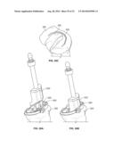 BICRUCIATE RETAINING TIBIAL IMPLANT SYSTEM diagram and image