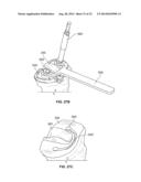 BICRUCIATE RETAINING TIBIAL IMPLANT SYSTEM diagram and image