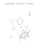 MEDICAL DEVICES FOR USE ALONG THE BILIARY AND/OR PANCREATIC TRACT diagram and image