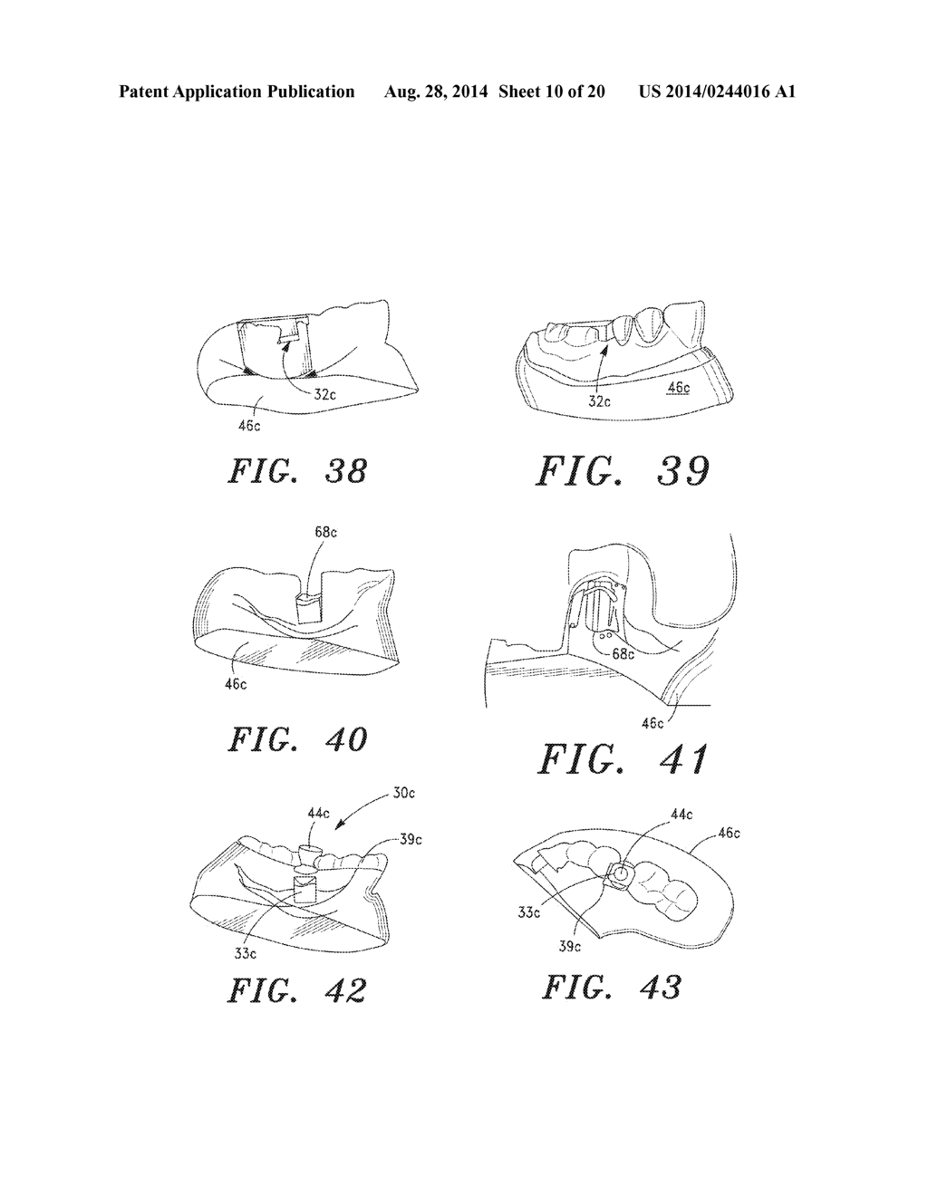 SURGICAL GUIDE AND METHOD - diagram, schematic, and image 11