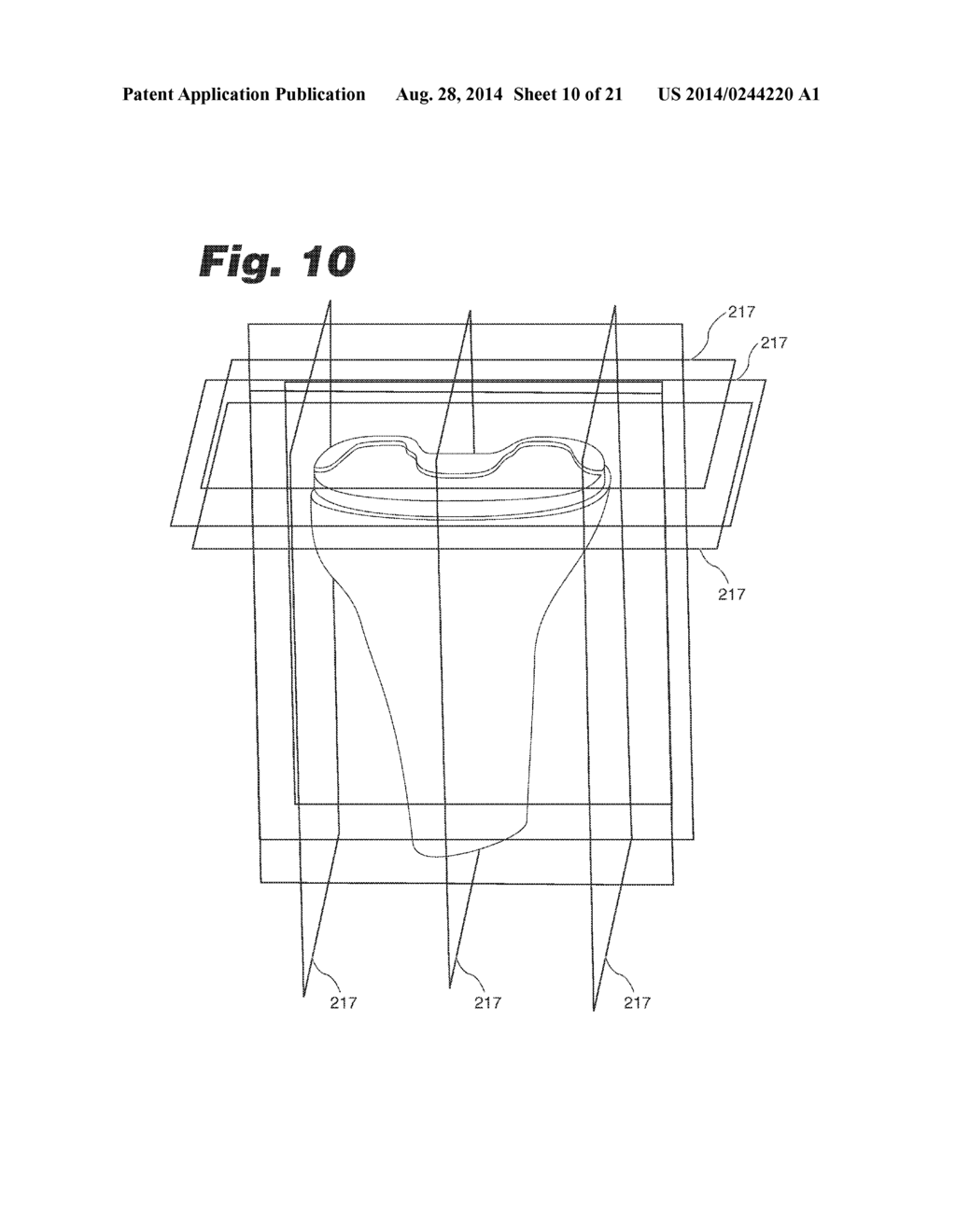 SYSTEMS AND METHODS FOR OPTIMIZING FIT OF AN IMPLANT TO ANATOMY - diagram, schematic, and image 11