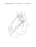 Trendelenburg Patient Restraint For Surgery Tables diagram and image