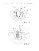 Wear Sensor diagram and image