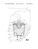 BEVERAGE BREWING DEVICE diagram and image